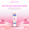 [SEESEE] Sữa rửa mặt Kiềm dầu, Ngừa mụn, Làm sạch sâu ổ viêm