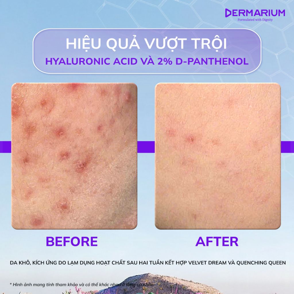 PHỤC HỒI ĐẬM SÂU – Dermarium