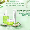 COMBO NGỪA MỤN SÁNG DA ( 1 Kem dưỡng  + 1 Serum + 1 Gel chấm mụn )