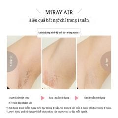  Máy triệt lông Mytrex Miray Air 