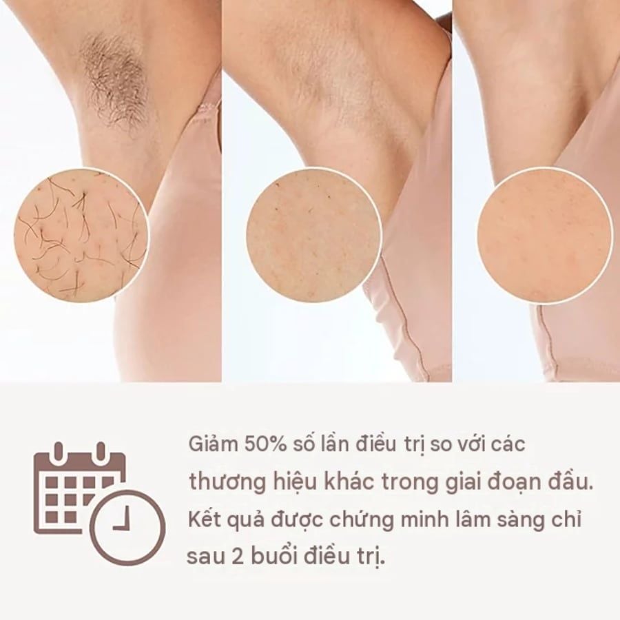 Máy Triệt Lông Philips Lumea IPL 8000 BRI947/00