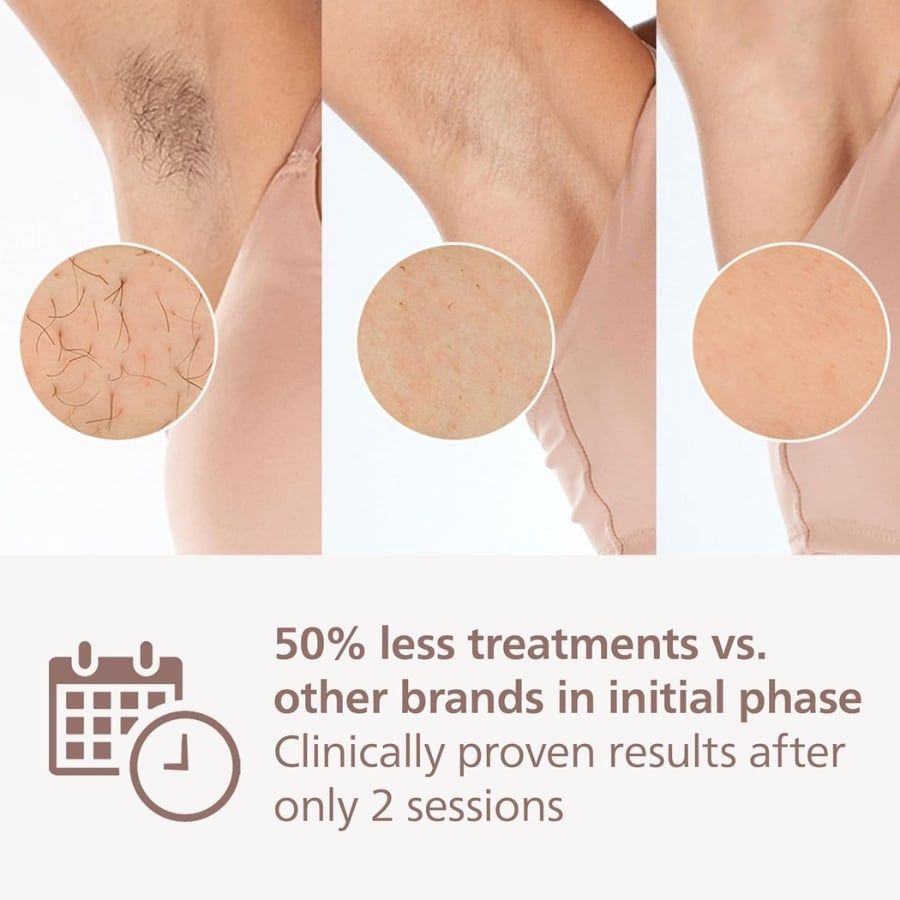 Máy triệt lông không dây Philips Lumea IPL 9900 Series BRI953/02