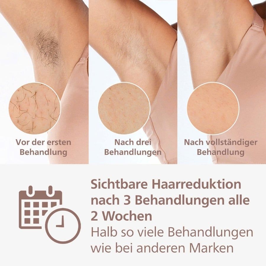 Máy triệt lông Philips Lumea IPL Series 9000 BRI958/00 - Slovenia.