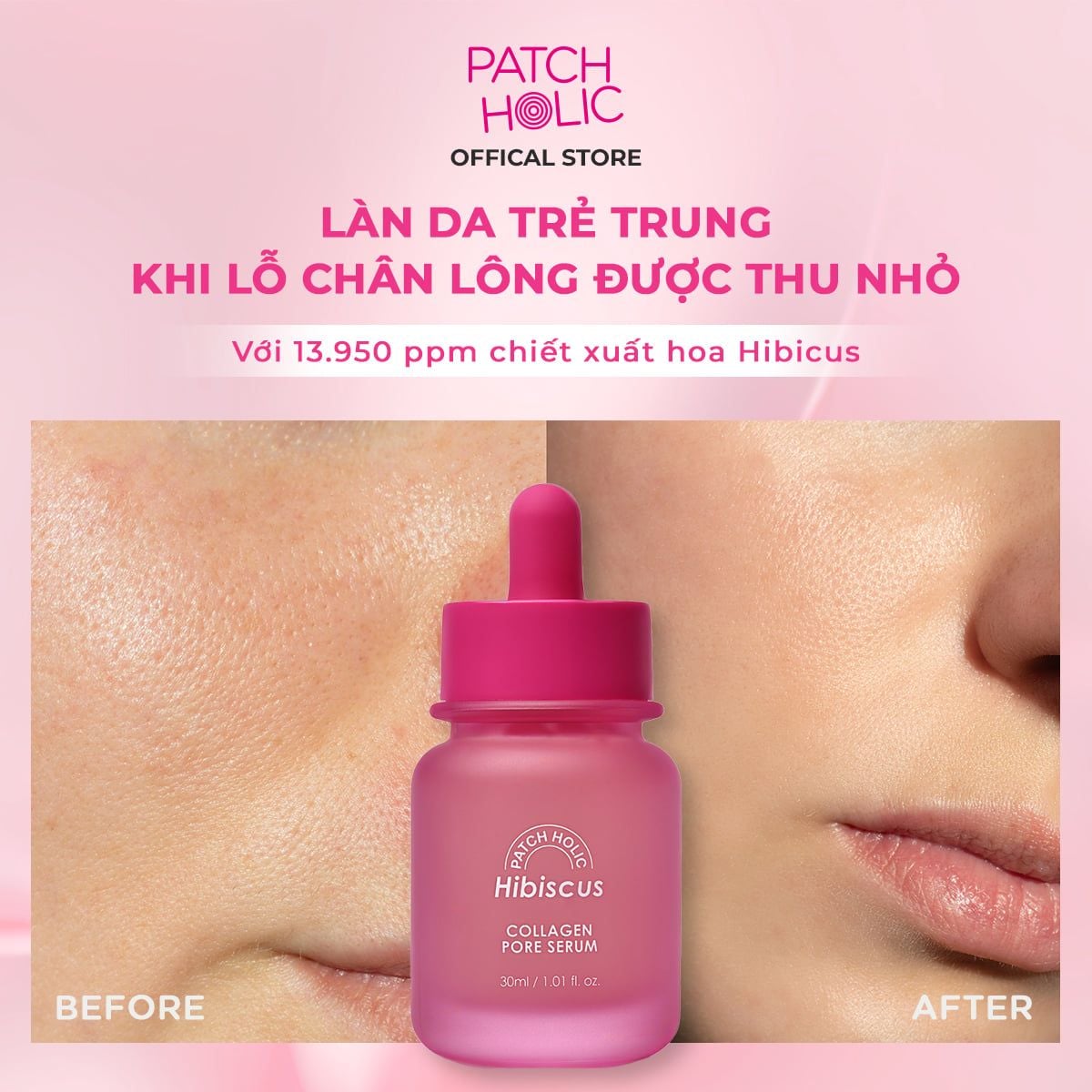  Serum Giảm Nếp Nhăn Và Se Nhỏ Lỗ Chân Lông Patch Holic 