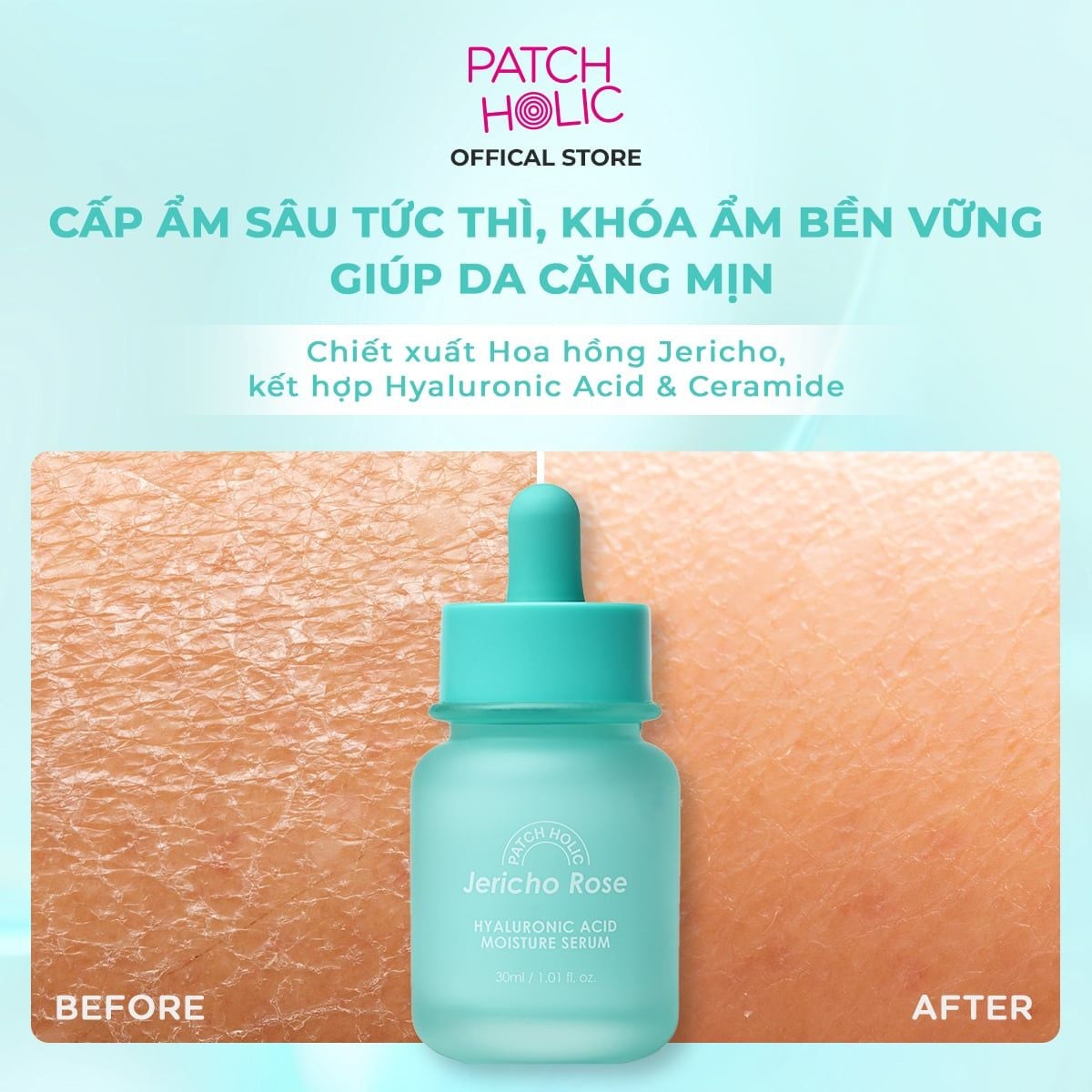  Serum Cấp Ẩm Chiết Xuất Hoa Hồng Jericho Patch Holic 