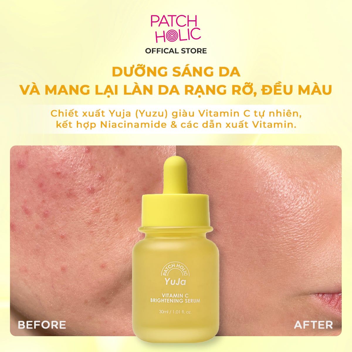  Serum Làm Sáng Da Juja Vitamin C Patch Holic 