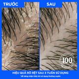  Dầu gội & xả trị gàu 2 trong 1 Head & Shoulder Classic Clean - Dưỡng tóc mềm mượt 