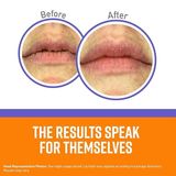  (SALE-SNL) Son dưỡng môi không mùi O'Keeffe's Lip Repair Night Treatment Unflavored Lip Balm 0.25Oz 7g 