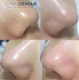  NK - Toner Pad AHA Tẩy tế bào chết SenaDemar 70 miếng 150ml 