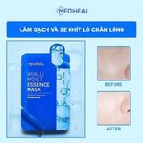  NK - Bịch 15 miếng mặt nạ Mediheal Hyalu Moist Essential Mask- Xanh dương 