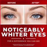  Nước Nhỏ Mắt Giảm Khô Đỏ Mắt Clear Eyes Maximum Redness Relief 0.5Oz 15ml (Chai) 