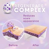  Kem bôi sẹo Cicatricure Advanced Scar Gel for Face & Body 1OZ 28g 