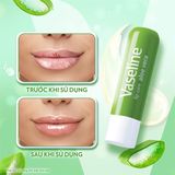  NK - Son dưỡng môi Lô hội giúp dưỡng ẩm, ngừa nứt nẻ môi Vaseline Lip Care Aloe Vera 0.16Oz 4.8g 