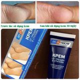  NK - Kem dưỡng da chân Before & After, Foot Cream For Cracker Feet 50ml 