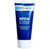  NK - Kem dưỡng da chân Before & After, Foot Cream For Cracker Feet 50ml 