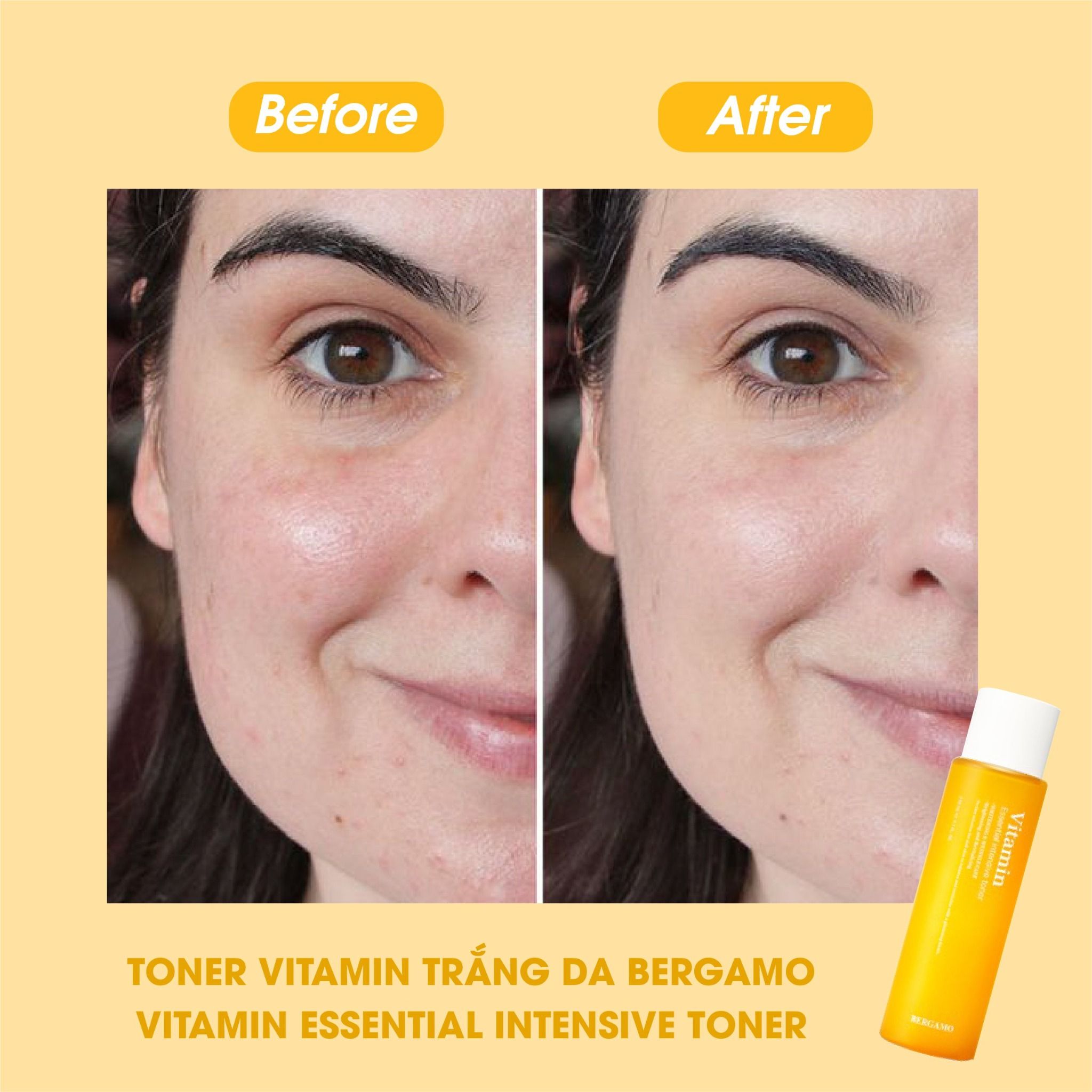 TONER VITAMIN SÁNG DA BERGAMO VITAMIN ESSENTIAL INTENSIVE TONER 210ML