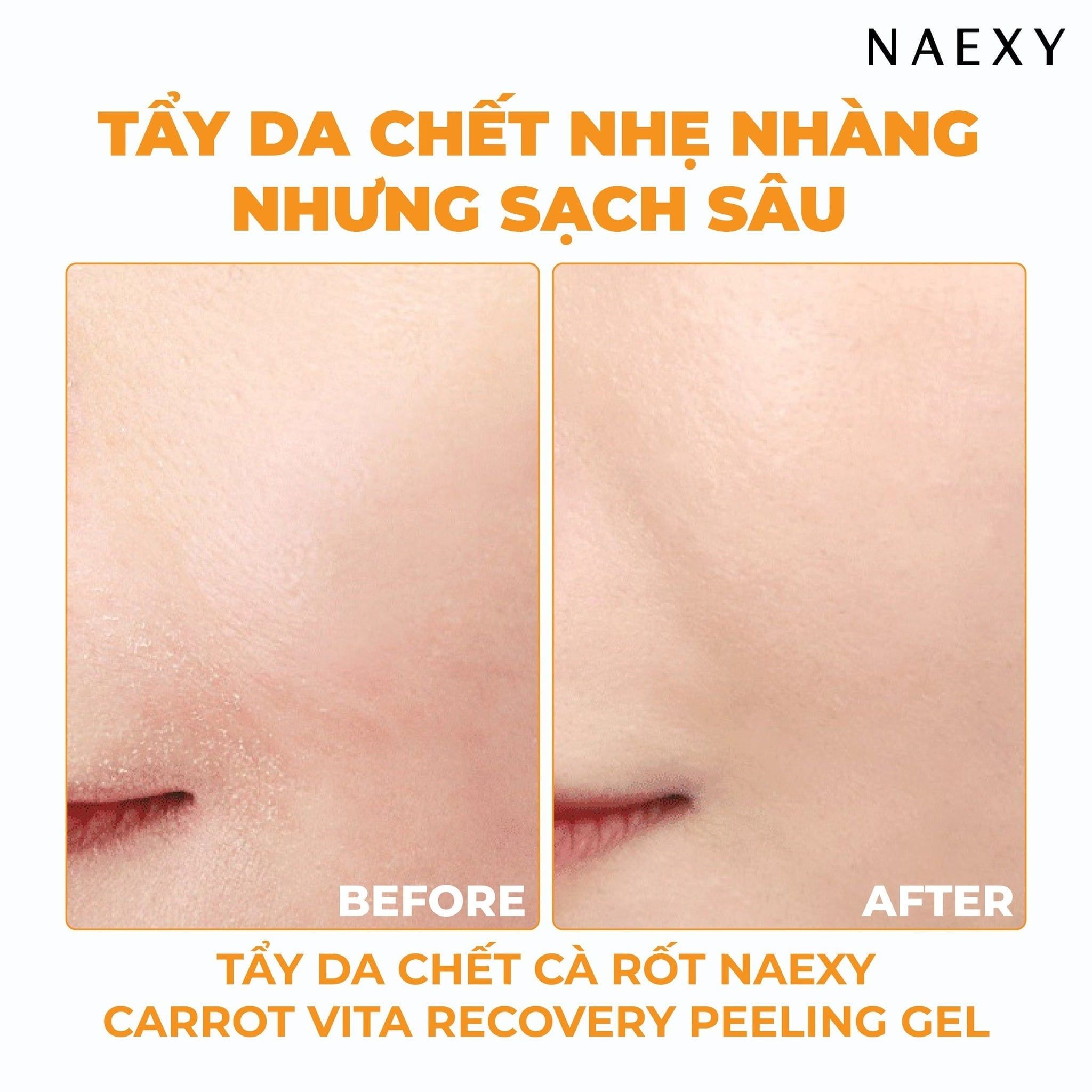 TẨY DA CHẾT CÀ RỐT NAEXY CARROT VITA RECOVERY PEELING GEL 150ML