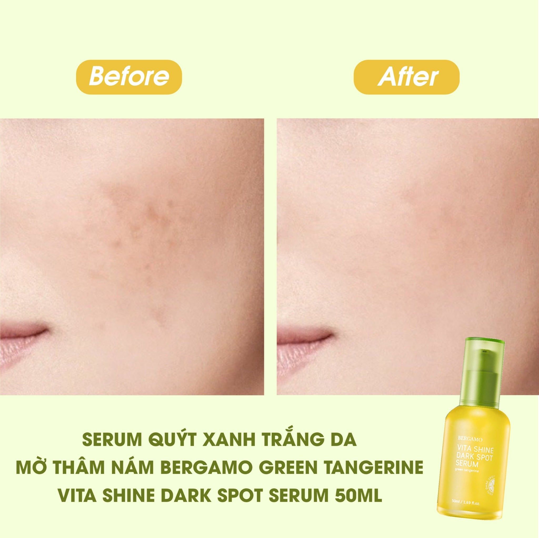 SERUM QUÝT XANH SÁNG DA MỜ THÂM NÁM BERGAMO GREEN TANGERINE VITA SHINE DARK SPOT SERUM 50ML