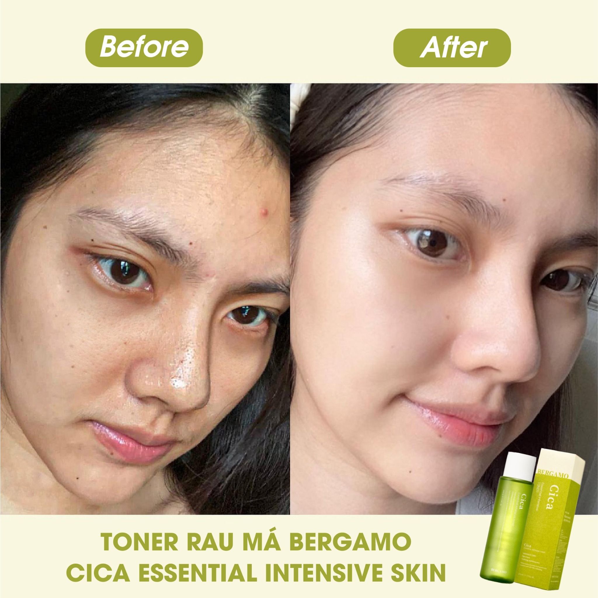 TONER RAU MÁ BERGAMO CICA ESSENTIAL INTENSIVE TONER 210ML