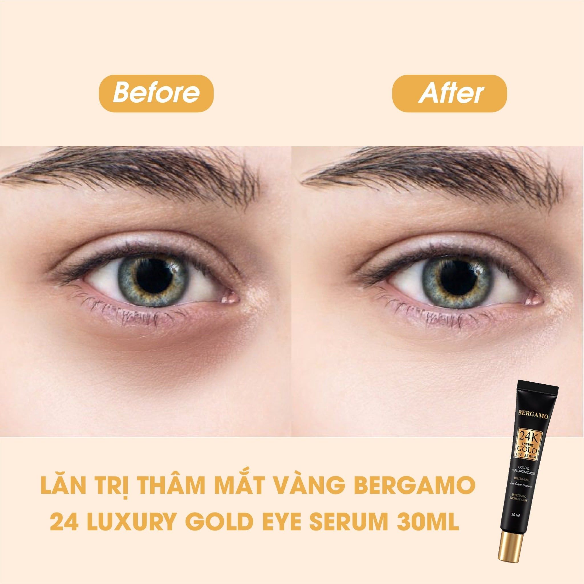 LĂN GIẢM THÂM MẮT VÀNG BERGAMO 24K LUXURY GOLD EYE SERUM 30ML