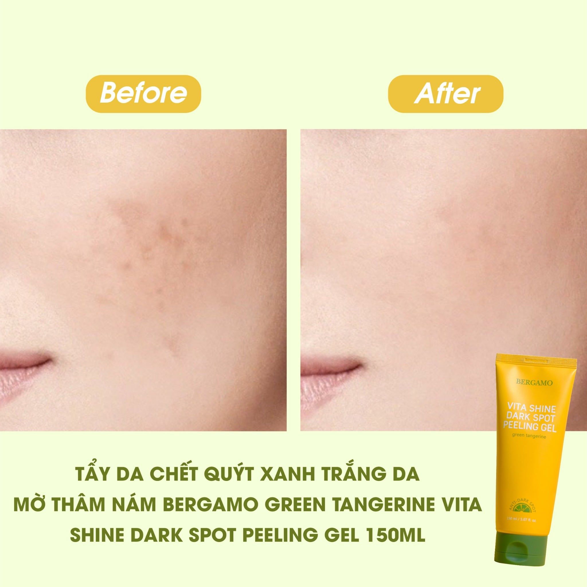 TẨY DA CHẾT QUÝT XANH SÁNG DA MỜ THÂM NÁM BERGAMO GREEN TANGERINE VITA SHINE DARK SPOT PEELING GEL 150ML