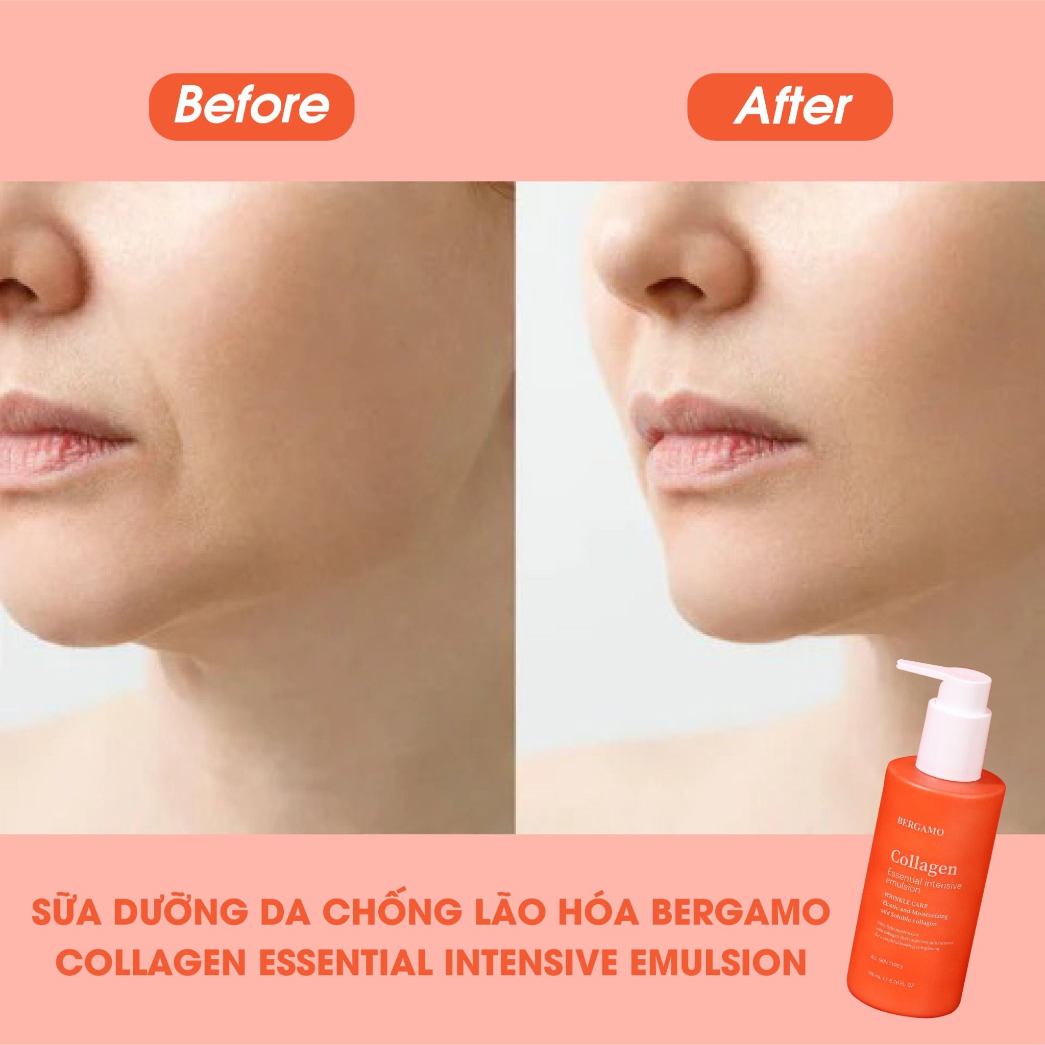 SỮA DƯỠNG DA CHỐNG LÃO HÓA BERGAMO COLLAGEN ESSENTIAL INTENSIVE EMULSION 200ML