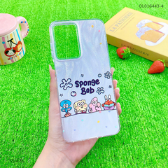 Ốp SS A26 vân ánh sóng nhiều hình