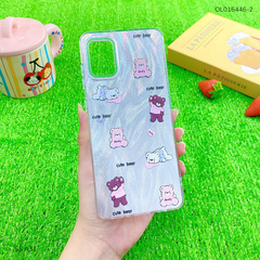 Ốp SS A31 vân ánh sóng nhiều hình