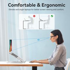 ** Giá đỡ Laptop Vention Silver