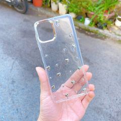 ** Ốp SS A07 dẻo lưng kim tuyến đính charm