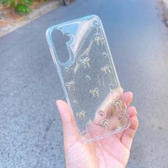 ** ỐP SS A14 dẻo lưng kim tuyến đính charm