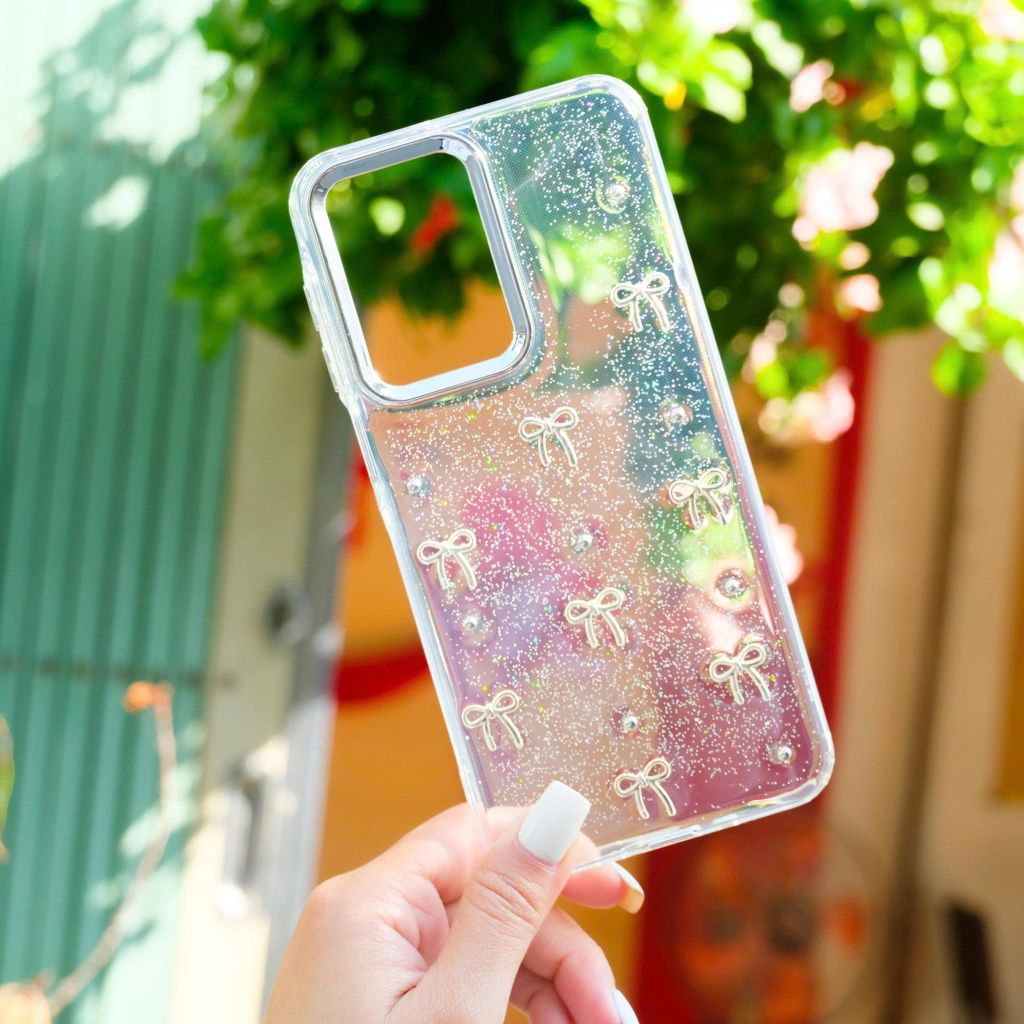 ** ỐP SS A15 dẻo lưng kim tuyến đính charm