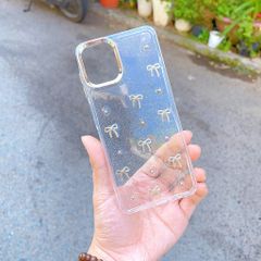 ** Ốp SS A07 dẻo lưng kim tuyến đính charm
