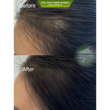  Phấn Che Khuyết Điểm Tóc Che Hói TheFaceShop Quick Hair Puff 7g 