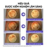  [Hàng Công Ty] Bộ kem dưỡng trắng da toàn diện cao cấp 5 món OHUI Extreme White Cream 5pcs Set 150ml 