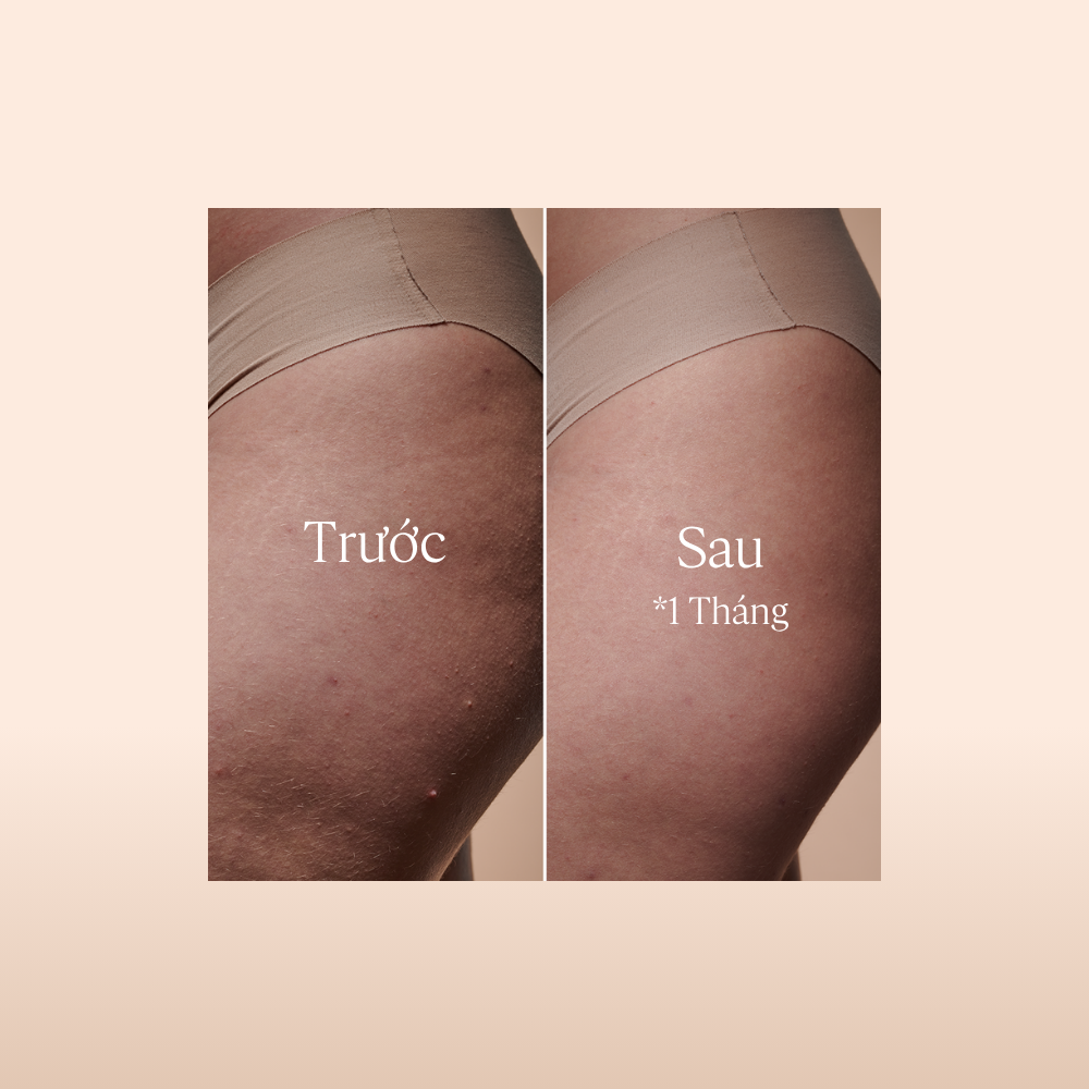 Dầu Dưỡng Thể Hạnh Nhân