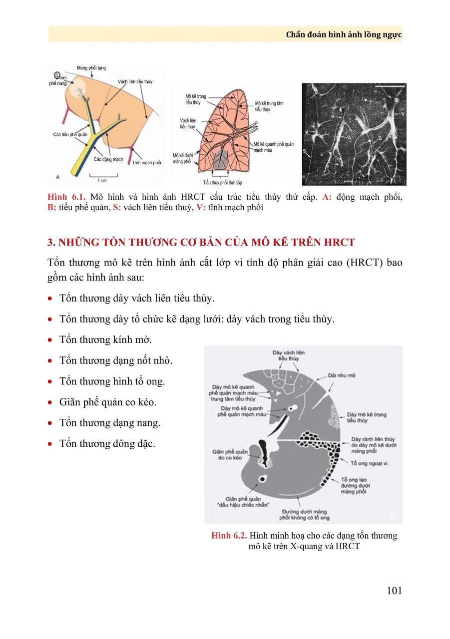 Chấn Đoán Hình Ảnh Lồng Ngực - PGS.TS. Vũ Đăng Lưu, PGS.TS. Đoàn Tiến Lưu