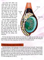 Cơ Thể Của Tôi Hoạt Động Như Thế Nào Sinh Sản - T.R.Bhanot