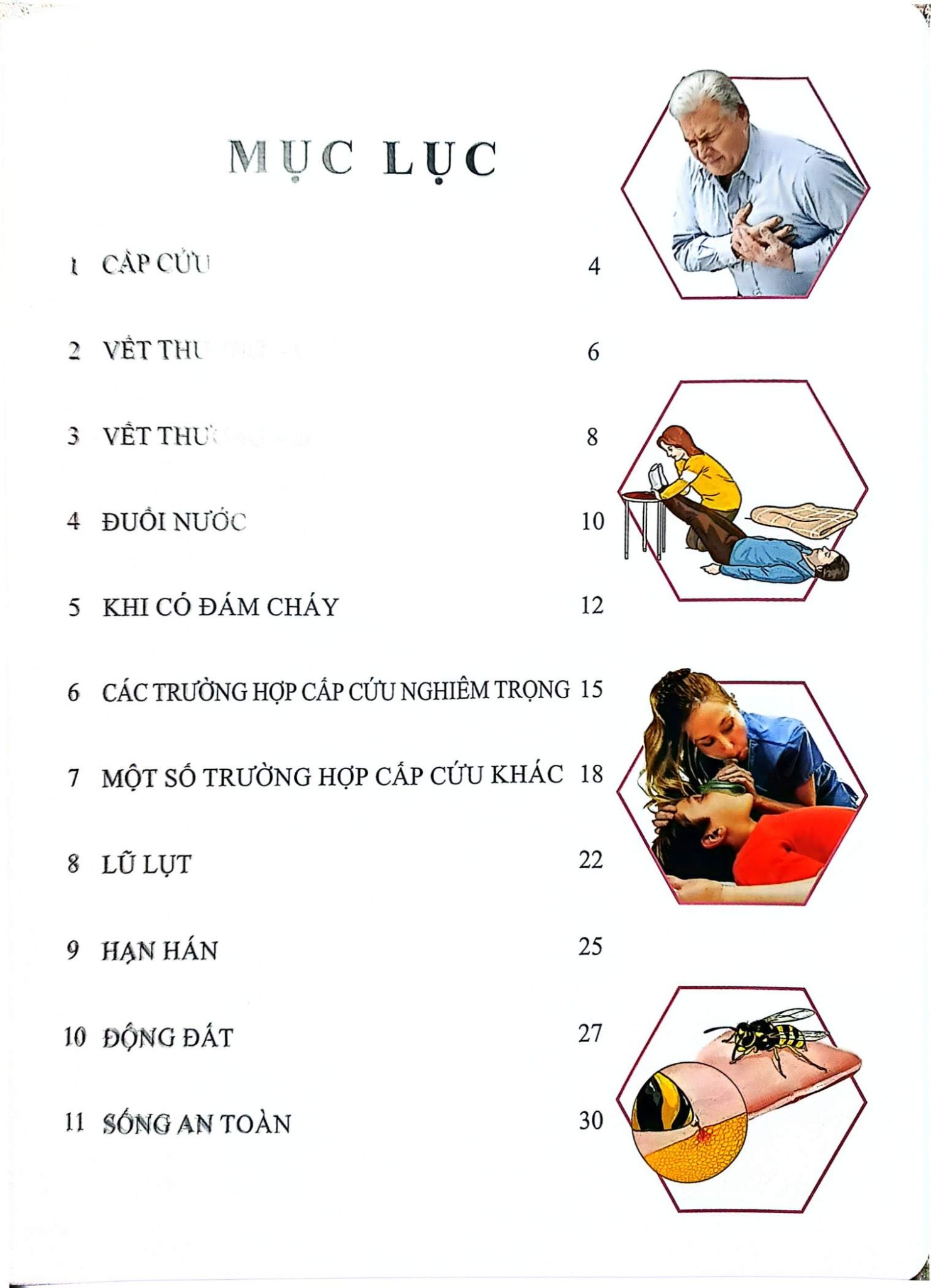 Cơ Thể Của Tôi Hoạt Động Như Thế Nào - Cấp Cứu - T.R.Bhanot
