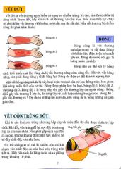 Cơ Thể Của Tôi Hoạt Động Như Thế Nào - Cấp Cứu - T.R.Bhanot