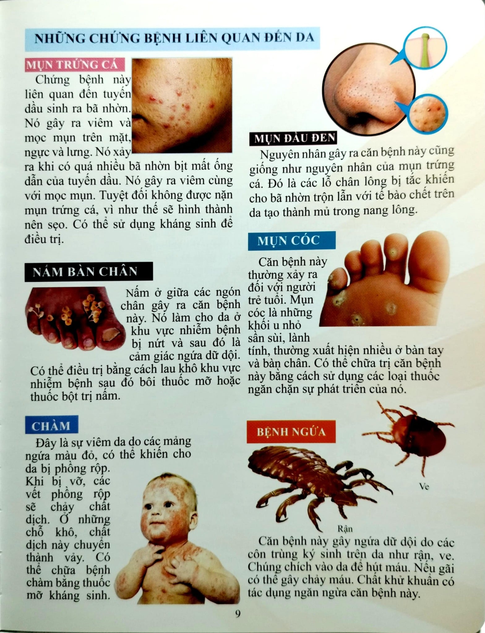 Cơ Thể Của Tôi Hoạt Động Như Thế Nào:- Chăm Sóc Cơ Thể - T.R.Bhanot