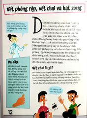 Khoa Học Diệu Kì: Mụn Trứng Cá Và Mụn Cóc - Sự Thật Ngứa Ngáy Về Da - Nhiều Tác Giả