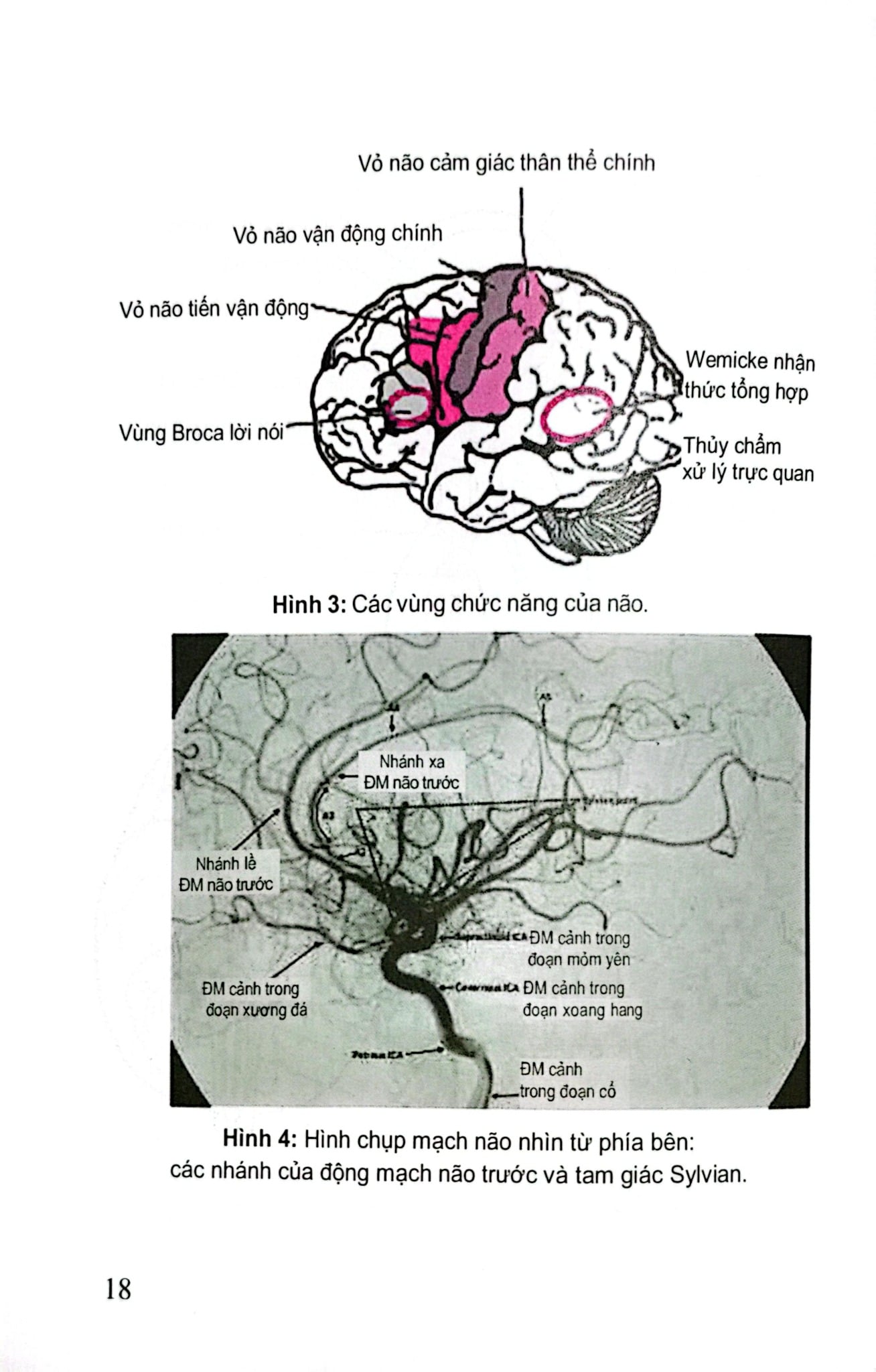 Đột Quỵ Não Những Điều Thiết Yếu Trong Thực Hành Lâm Sàng - PGS.TS. Tạ Mạnh Cường