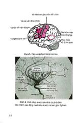 Đột Quỵ Não Những Điều Thiết Yếu Trong Thực Hành Lâm Sàng - PGS.TS. Tạ Mạnh Cường