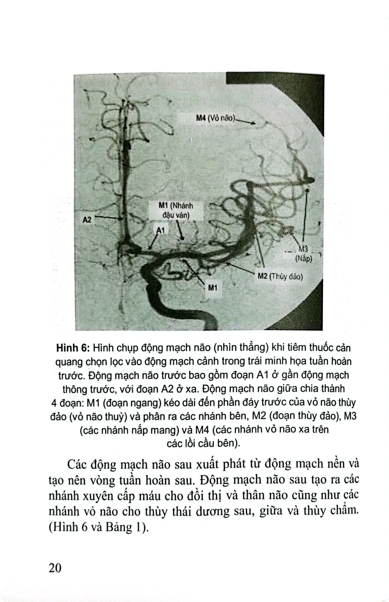 Đột Quỵ Não Những Điều Thiết Yếu Trong Thực Hành Lâm Sàng - PGS.TS. Tạ Mạnh Cường