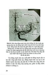 Đột Quỵ Não Những Điều Thiết Yếu Trong Thực Hành Lâm Sàng - PGS.TS. Tạ Mạnh Cường