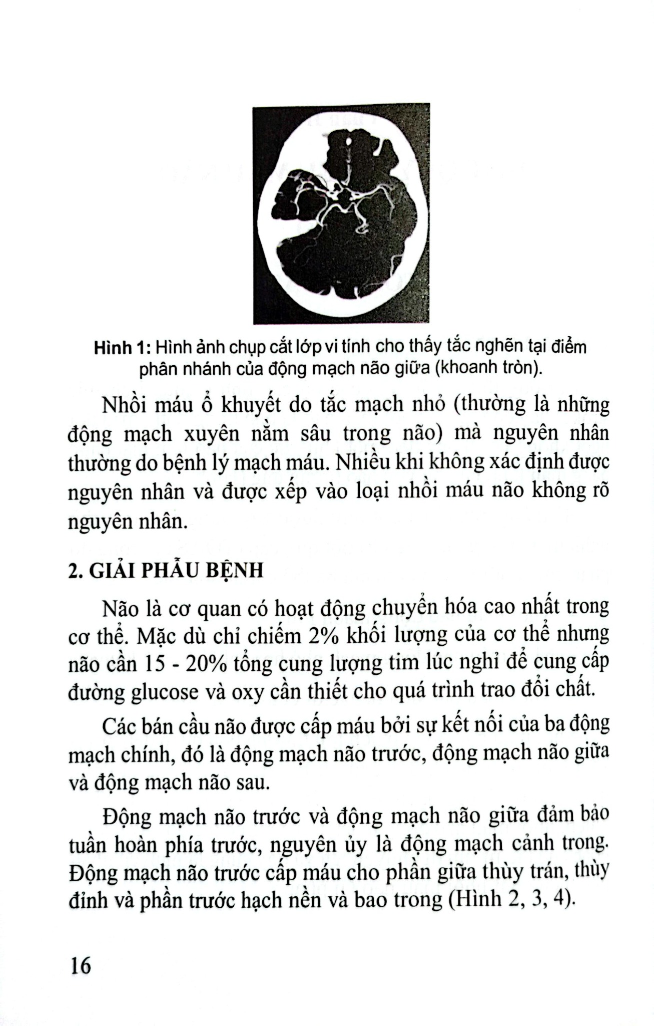 Đột Quỵ Não Những Điều Thiết Yếu Trong Thực Hành Lâm Sàng - PGS.TS. Tạ Mạnh Cường