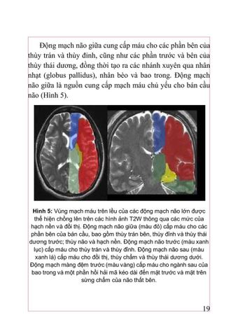  Đột Quỵ Não Những Điều Thiết Yếu Trong Thực Hành Lâm Sàng - PGS.TS. Tạ Mạnh Cường 