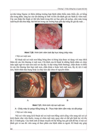  Triệu Chứng Học Nội Khoa Tập 2 (2025) - ĐH Y Hà Nội - Các Bộ Môn Nội 