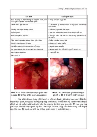  Triệu Chứng Học Nội Khoa Tập 2 (2025) - ĐH Y Hà Nội - Các Bộ Môn Nội 